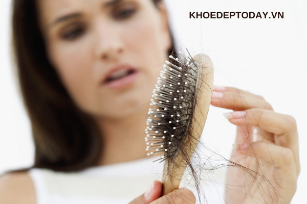 Rụng tóc nhiều và nhanh 