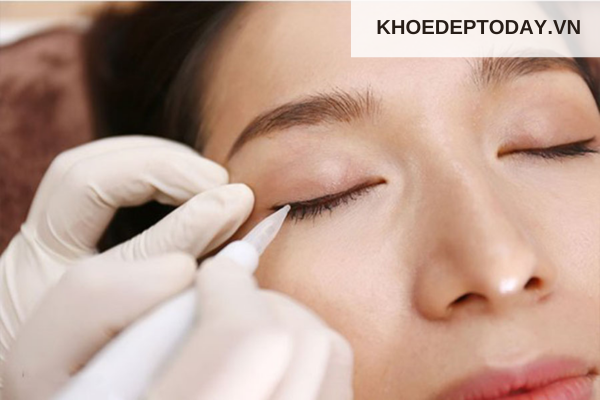 Khi nào nên chọn phun mí thay vì kẻ eyeliner?