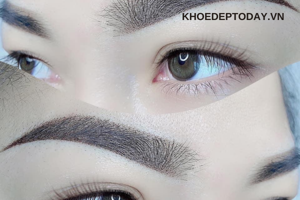 Khử đỏ bằng kỹ thuật phun mày "cover" (phủ màu)