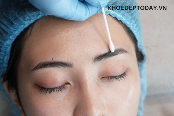 Xóa bằng dung dịch hút mực