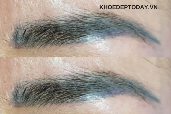 Mức độ trổ xanh