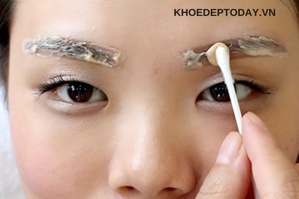 Xử lý bằng dung dịch hút mực