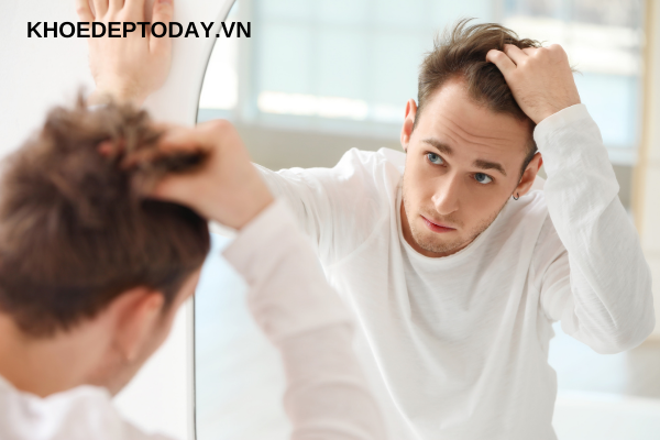 Một số nguyên nhân khác dẫn đến việc rụng tóc ở nam giới