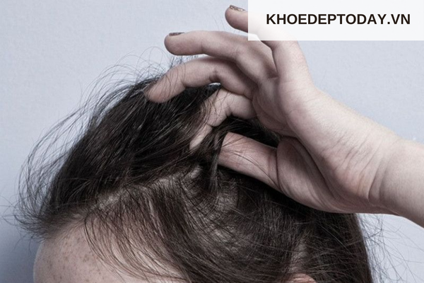 Cách cải thiện sợi tóc sần sùi