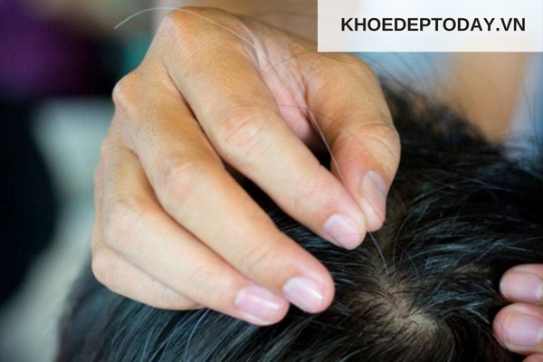 Một số nguyên nhân khác