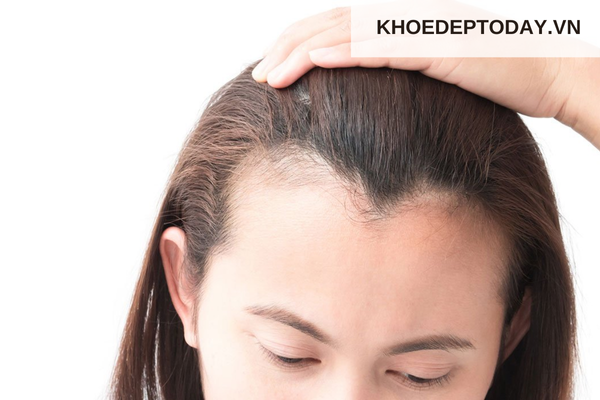 Tác động từ môi trường