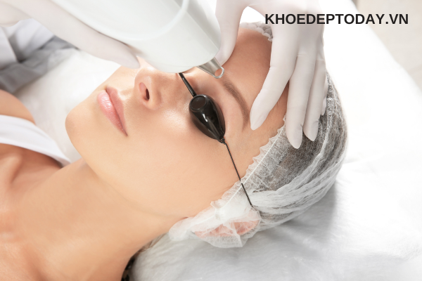 Sau khi xóa chân mày bằng laser