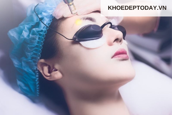 Xoá chân mày điêu khắc có hết không?