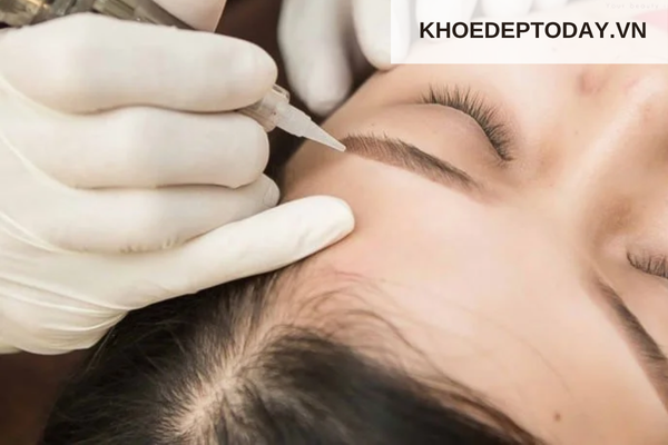 Xoá chân mày phun có để lại sẹo không?